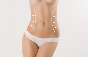 Liposucción en Clínica Euskalduna